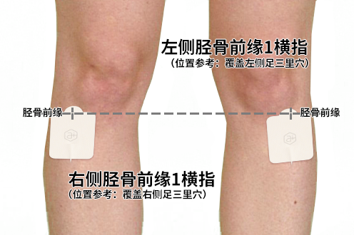 胫骨前缘具体位置图片